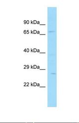Western blot of Human 721_B. SNX33 antibody dilution 1.0 ug/ml.