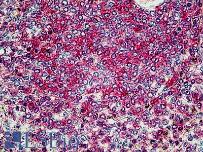 Anti-SNX4 antibody IHC of human spleen. Immunohistochemistry of formalin-fixed, paraffin-embedded tissue after heat-induced antigen retrieval. Antibody LS-B5103 concentration 3.75 ug/ml.