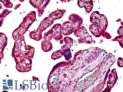 Anti-SNX4 antibody IHC of human placenta. Immunohistochemistry of formalin-fixed, paraffin-embedded tissue after heat-induced antigen retrieval. Antibody LS-B5103 concentration 3.75 ug/ml.