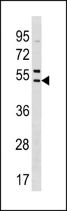 SNX5 Antibody western blot of HL-60 cell line lysates (35 ug/lane). The SNX5 antibody detected the SNX5 protein (arrow).