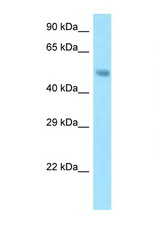 SNX5 antibody LS-C146278 Western blot of Mouse Pancreas lysate. Antibody concentration 1 ug/ml.