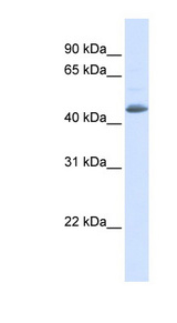 SNX5 antibody LS-C102578 Western blot of 293T cell lysate.