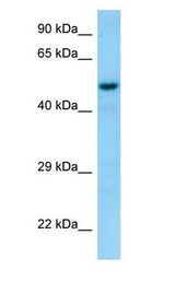 SNX6 antibody Western Blot of Human Placenta.
