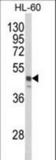 Western blot of SNX6 Antibody in HL-60 cell line lysates (35 ug/lane). SNX6 (arrow) was detected using the purified antibody.