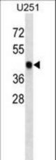 SNX6 Antibody western blot of U251 cell line lysates (35 ug/lane). The SNX6 antibody detected the SNX6 protein (arrow).