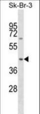 SNX7 Antibody western blot of SK-BR-3 cell line lysates (35 ug/lane). The SNX7 antibody detected the SNX7 protein (arrow).