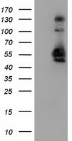 HEK293T cells were transfected with the pCMV6-ENTRY control (Left lane) or pCMV6-ENTRY SNX8 (Right lane) cDNA for 48 hrs and lysed. Equivalent amounts of cell lysates (5 ug per lane) were separated by SDS-PAGE and immunoblotted with anti-SNX8.