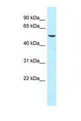 SNX8 antibody LS-C145897 Western blot of Fetal Heart lysate. Antibody concentration 1 ug/ml.
