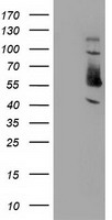 HEK293T cells were transfected with the pCMV6-ENTRY control (Left lane) or pCMV6-ENTRY SNX8 (Right lane) cDNA for 48 hrs and lysed. Equivalent amounts of cell lysates (5 ug per lane) were separated by SDS-PAGE and immunoblotted with anti-SNX8.