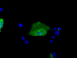 Anti-SNX9 mouse monoclonal antibody immunofluorescent staining of COS7 cells transiently transfected by pCMV6-ENTRY SNX9.