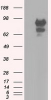 HEK293T cells were transfected with the pCMV6-ENTRY control (Left lane) or pCMV6-ENTRY SNX9 (Right lane) cDNA for 48 hrs and lysed. Equivalent amounts of cell lysates (5 ug per lane) were separated by SDS-PAGE and immunoblotted with anti-SNX9.