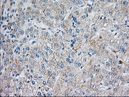 IHC of paraffin-embedded Human liver tissue using anti-SNX9 mouse monoclonal antibody. (Dilution 1:50).