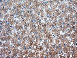 IHC of paraffin-embedded Human liver tissue using anti-SNX9 mouse monoclonal antibody. (Dilution 1:50).