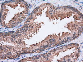 IHC of paraffin-embedded Human prostate tissue using anti-SNX9 mouse monoclonal antibody. (Dilution 1:50).