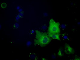 Anti-SNX9 mouse monoclonal antibody immunofluorescent staining of COS7 cells transiently transfected by pCMV6-ENTRY SNX9.