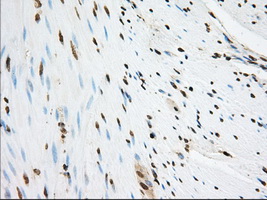 IHC of paraffin-embedded Human colon tissue using anti-SNX9 mouse monoclonal antibody. (Dilution 1:50).