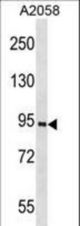 PROX1 Antibody (K507) western blot of A2058 cell line lysates (35 ug/lane). The PROX1 antibody detected the PROX1 protein (arrow).