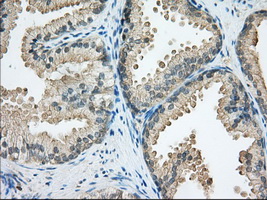 IHC of paraffin-embedded Human prostate tissue using anti-SNX9 mouse monoclonal antibody. (Dilution 1:50).