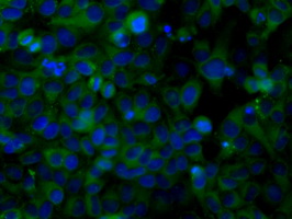 Immunofluorescent staining of HeLa cells using anti-SNX9 mouse monoclonal antibody.