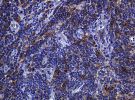 IHC of paraffin-embedded Human lymph node tissue using anti-SOAT2 mouse monoclonal antibody.