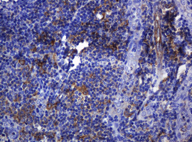 IHC of paraffin-embedded Human tonsil using anti-SOAT2 mouse monoclonal antibody.