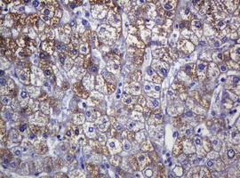 IHC of paraffin-embedded Human liver tissue using anti-SOAT2 mouse monoclonal antibody.