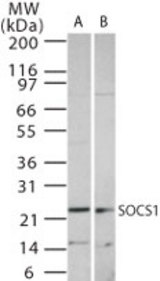 Western blot of SOCS1 using antibody at 1:1000 dilution against 15 ug/lane of Ramos (A) and Raw (B) cell lysate.