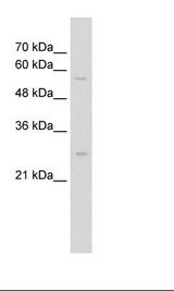 HepG2 Cell Lysate