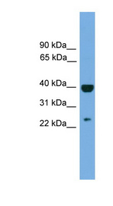 SOCS1 antibody LS-C116201 Western blot of ACHN lysate.