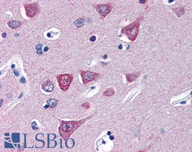 Anti-SOCS1 antibody IHC of human brain, cortex. Immunohistochemistry of formalin-fixed, paraffin-embedded tissue after heat-induced antigen retrieval. Antibody LS-B2698 concentration 5 ug/ml.