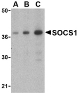 Western blot of SOCS1 in Human spleen cell lysate with SOCS1 antibody at (A) 1, (B) 2 and (C) 4 ug/ml.