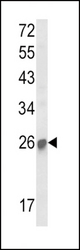 Western blot of SOCS1 Antibody in mouse kidney tissue lysates (35 ug/lane). SOCS1 (arrow) was detected using the purified antibody.