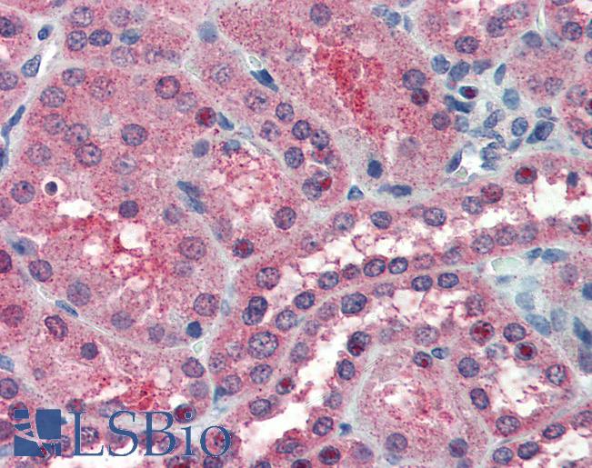 Anti-SOCS1 antibody IHC of human kidney. Immunohistochemistry of formalin-fixed, paraffin-embedded tissue after heat-induced antigen retrieval. Antibody LS-B2488 concentration 5 ug/ml.