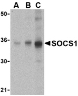 Western blot of SOCS1 in Human spleen cell lysate with SOCS1 antibody at (A) 1, (B) 2 and (C) 4 ug/ml.