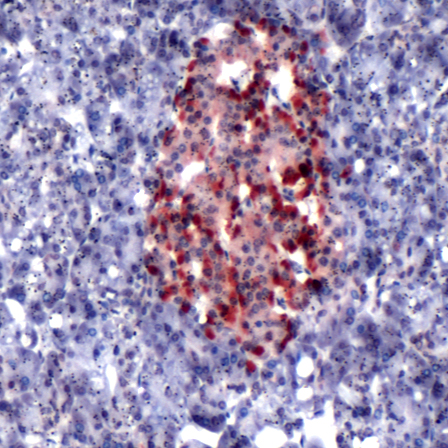 Immunohistochemistry of Human Pancreas stained with anti-SOCS-2 antibody