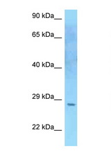 SOCS2 antibody LS-C146248 Western blot of U937 Cell lysate. Antibody concentration 1 ug/ml.