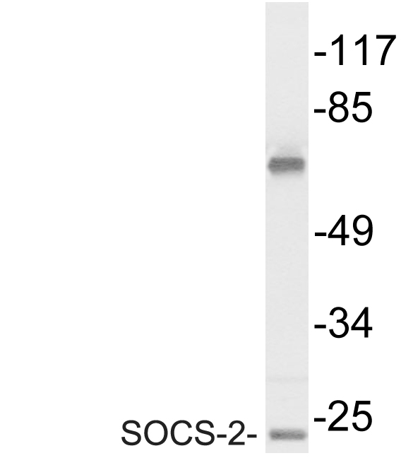 Western blot of SOCS-2 antibody in extracts from Jurkat cells.