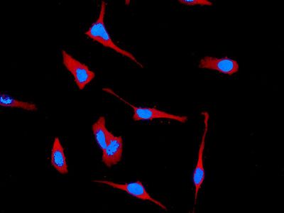 Immunofluorescent staining of HeLa cells using anti-SOCS2 antibody.