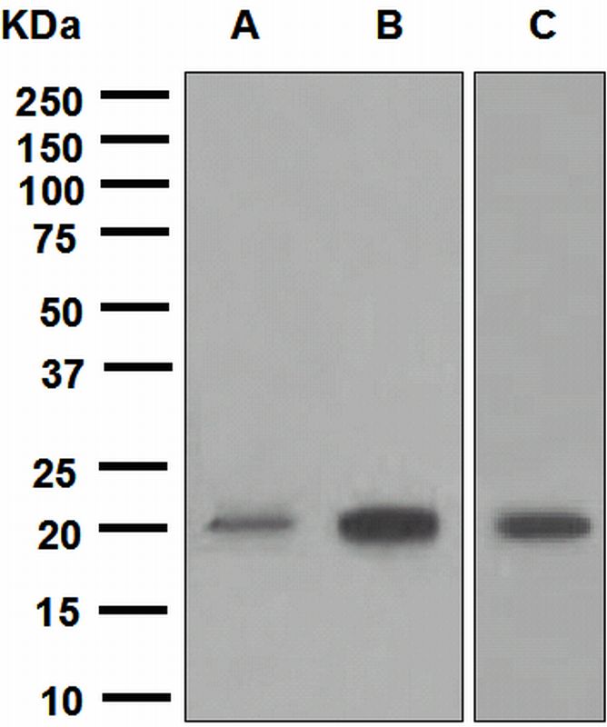 Western blot analysis on (A) MCF-7, (B) NCCIT, and (C) K562 cell lysates using anti-SOCS2 antibody.