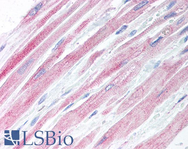 Anti-SOCS2 antibody IHC of human heart. Immunohistochemistry of formalin-fixed, paraffin-embedded tissue after heat-induced antigen retrieval. Antibody LS-B1257 concentration 20 ug/ml.