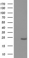 HEK293T cells were transfected with the pCMV6-ENTRY control (Left lane) or pCMV6-ENTRY SOCS3 (Right lane) cDNA for 48 hrs and lysed. Equivalent amounts of cell lysates (5 ug per lane) were separated by SDS-PAGE and immunoblotted with anti-SOCS3.