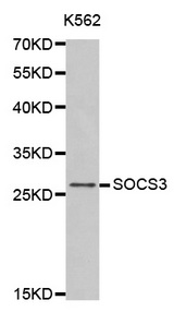 Western blot analysis of extracts of K562 cells tissue, using SOCS3 antibody.