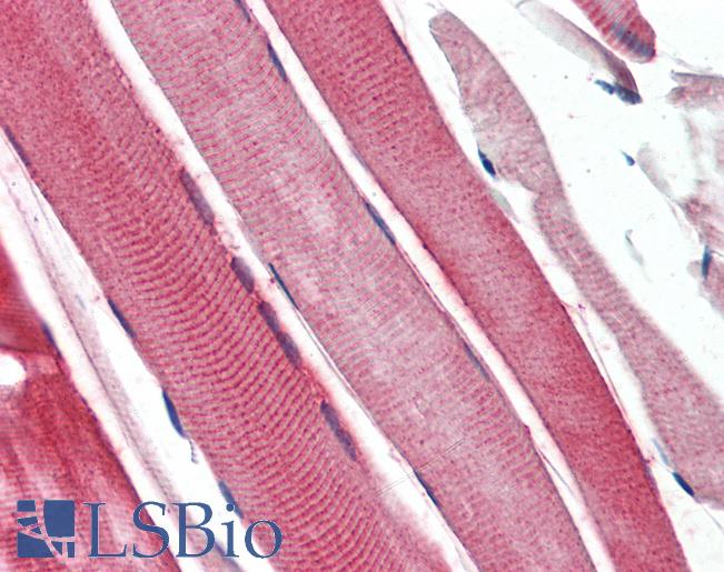 Anti-SOCS3 antibody IHC of human skeletal muscle. Immunohistochemistry of formalin-fixed, paraffin-embedded tissue after heat-induced antigen retrieval. Antibody LS-B3373 concentration 10 ug/ml.