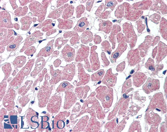 Anti-SOCS3 antibody IHC of human heart. Immunohistochemistry of formalin-fixed, paraffin-embedded tissue after heat-induced antigen retrieval. Antibody LS-B3373 concentration 10 ug/ml.