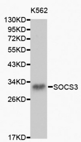 Western blot analysis of K562 cell lysate using SOCS3 antibody.