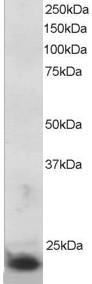 Antibody staining (5 ug/ml) of MOLT-4 lysate (RIPA buffer, 30 ug total protein per lane). Primary incubated for 1 hour. Detected by Western blot of chemiluminescence.