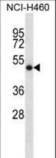 SOCS4 Antibody western blot of NCI-H460 cell line lysates (35 ug/lane). The SOCS4 antibody detected the SOCS4 protein (arrow).