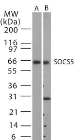 Western blot analysis for SOCS5 using antibody at 1:500 dilution against 15 ug/lane of mouse spleen (lane A) and human spleen (lane B) lysates.