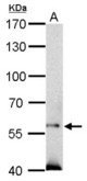 SOCS5 antibody detects SOCS5 protein by Western blot analysis. A. 50 ug mouse testis lysate/extract. 7.5 % SDS-PAGE. SOCS5 antibody dilution:1:500