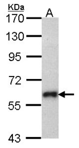 Sample (30 ug of whole cell lysate). A: Molt-4 . 7.5% SDS PAGE. SOCS5 antibody. SOCS5 antibody diluted at 1:1000.